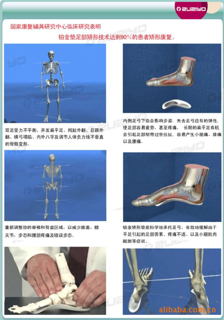 足之友纳米银 内八字矫正 足部骨骼矫形垫 扁平足矫正