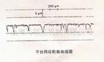 卧式长珩磨条