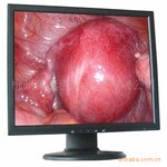 Һ�����������ڿ�������ϵͳ�ü�������19Ӣ��
