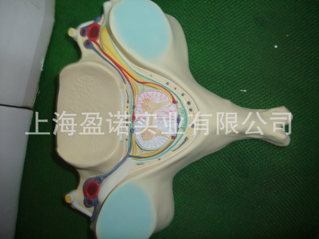 第五颈椎模型 颈椎附骨髓神经 放大模型 神经科