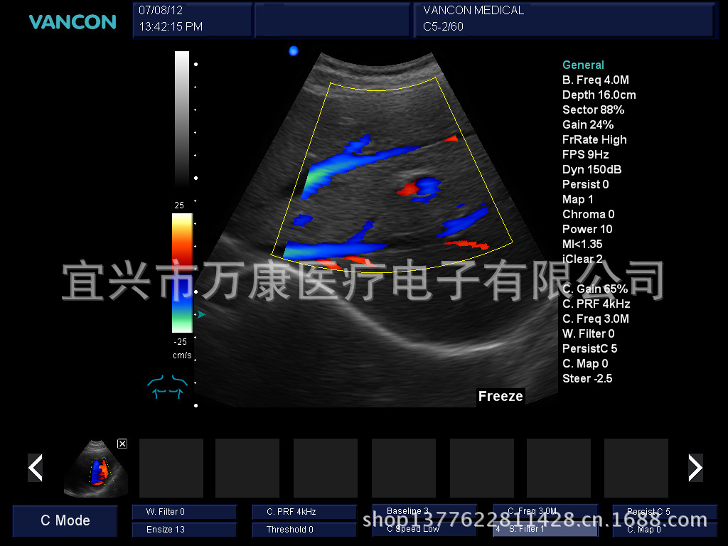 cfm liver