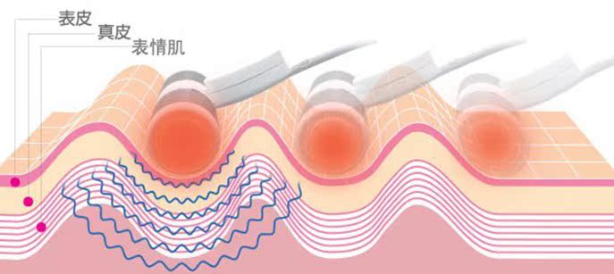 批发采购按摩器材-热卖塑可儿瘦脸风火轮 电动