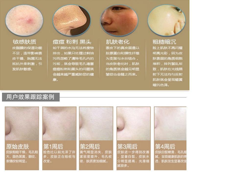微頻超導瘦面機