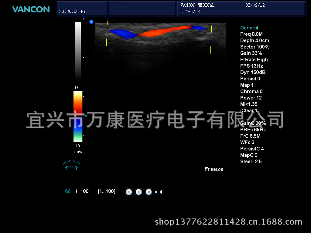 手指血流