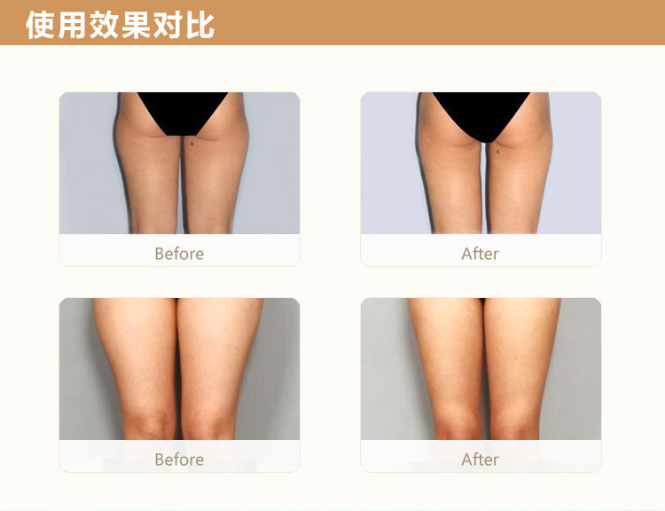 柏露詩瘦大腿_08