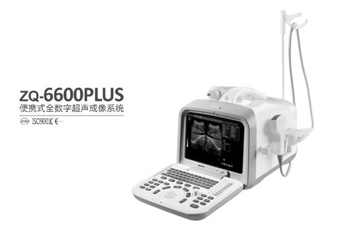 ZQ-6600PLUS便攜式全數字超聲系統