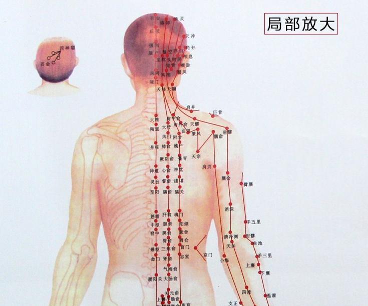 拔罐必备 人体经络图挂图 穴位图 附常用病例拔罐参考双面拔罐书