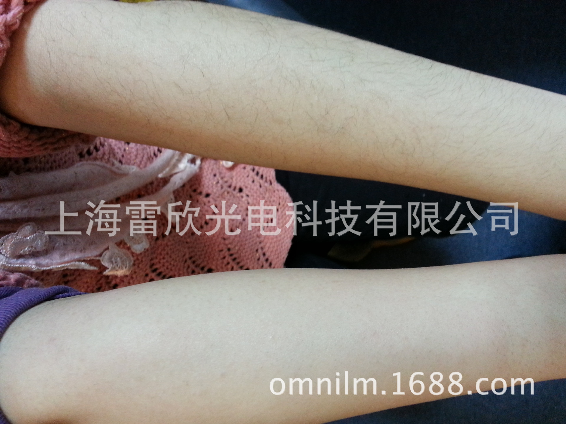 脱毛左右手对比