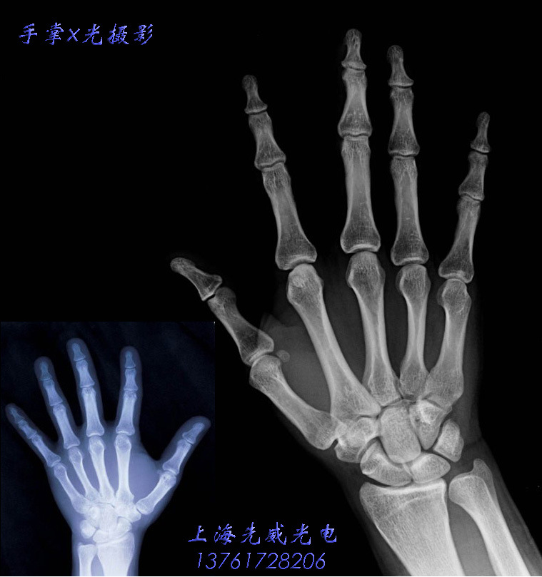 2194-1103120Q32544副本