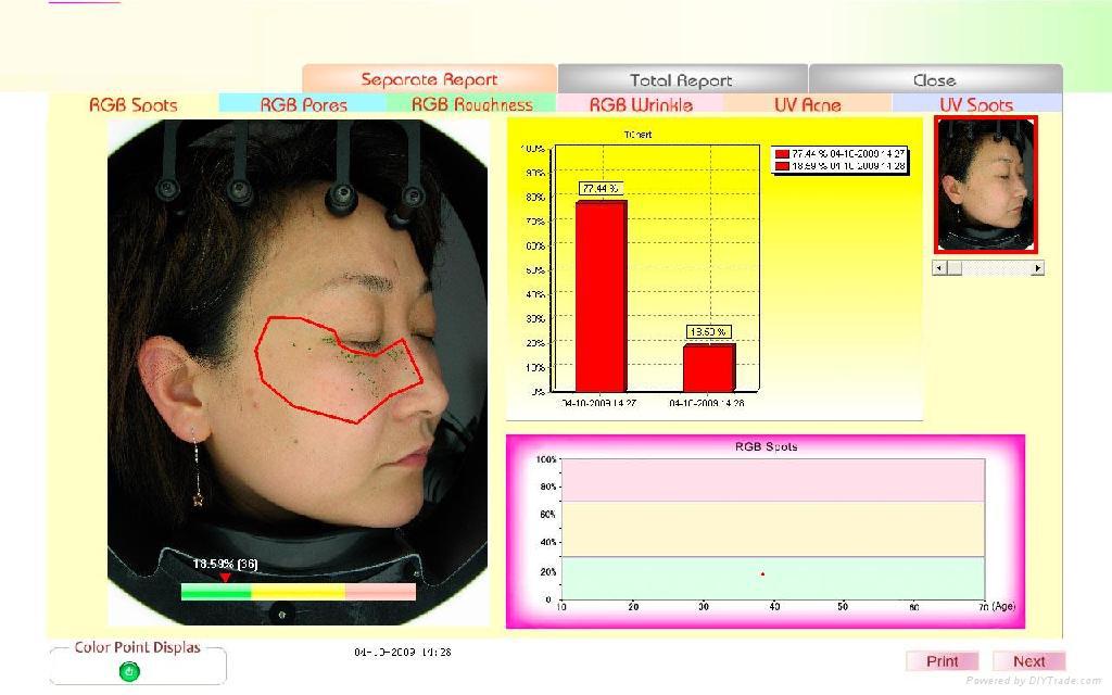 批发采购美容仪器-专业魔镜皮肤检测仪,面部C