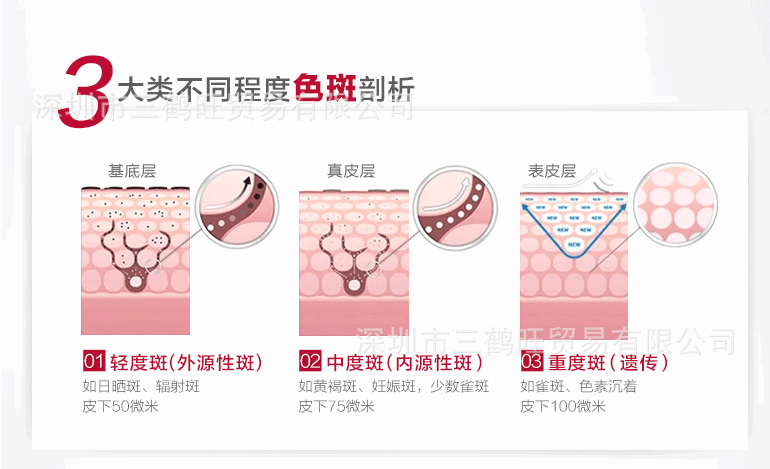 內分泌色斑煥白套裝（重度） (4)