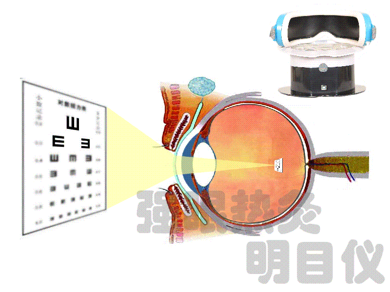 产家批发零售强眼热灸明目仪近视治疗仪弱视治疗仪眼保健仪增视仪