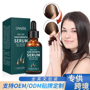 羳QlҺlҺHair growth solution^lIBҺÓlA