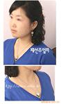 ��Ӧ�ձ��߾���YUKIWA���ͷ