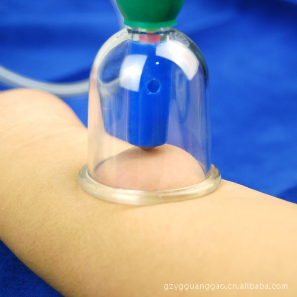 供应拔罐器 康祝牌 加强型拔罐器