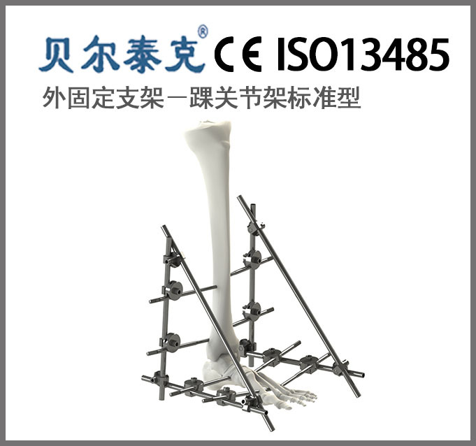 骨科组合式外固定支架踝关节架标准型